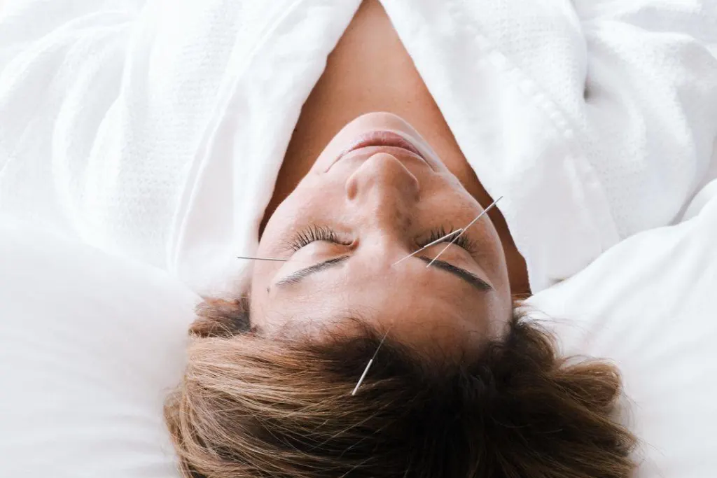 Carillon wellness retreat spa acupuncture